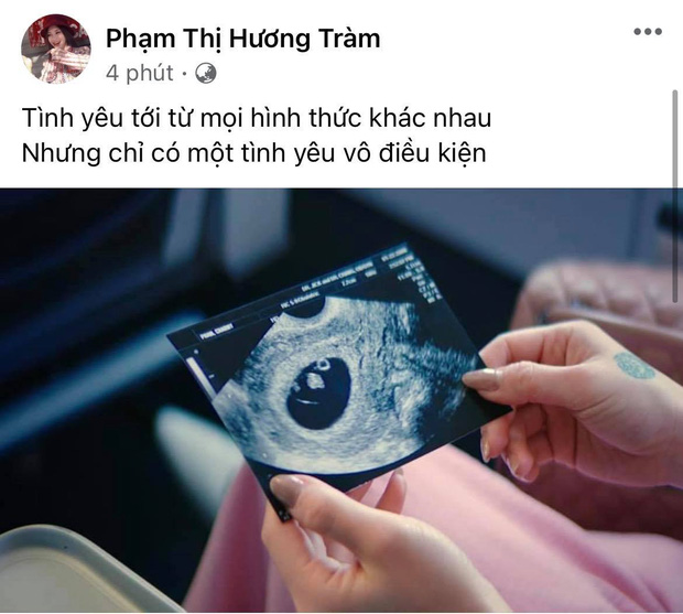 Động thái của Hương Tràm sau khi gây ồn ào vì khoe ảnh siêu âm, bị nghi đang mang thai - Ảnh 1.