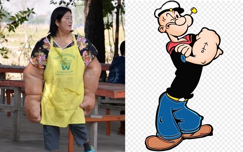 Người phụ nữ có đôi tay to như thủy thủ Popeye vì bệnh lạ vô phương cứu chữa - Ảnh 1.