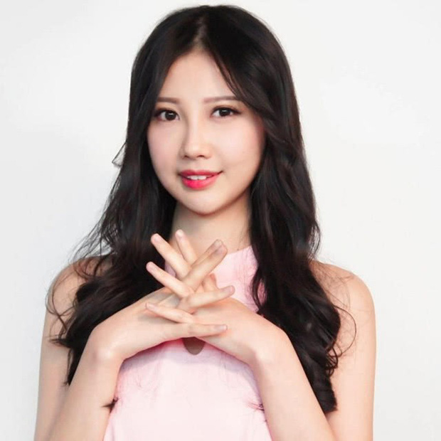 9 năm chiến đấu với bệnh ung thư hiếm gặp, nữ ca sĩ đã trút hơi thở cuối cùng ở tuổi 31 với gương mặt biến dạng - Ảnh 4. 9 năm chiến đấu với bệnh ung thư hiếm gặp, nữ ca sĩ đã trút hơi thở cuối cùng ở tuổi 31 với gương mặt biến dạng - Ảnh 4.