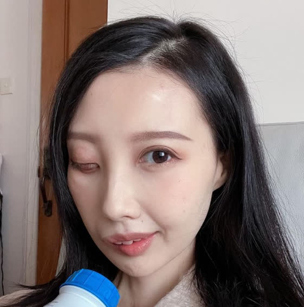 9 năm chiến đấu với bệnh ung thư hiếm gặp, nữ ca sĩ đã trút hơi thở cuối cùng ở tuổi 31 với gương mặt biến dạng - Ảnh 5. 9 năm chiến đấu với bệnh ung thư hiếm gặp, nữ ca sĩ đã trút hơi thở cuối cùng ở tuổi 31 với gương mặt biến dạng - Ảnh 5.