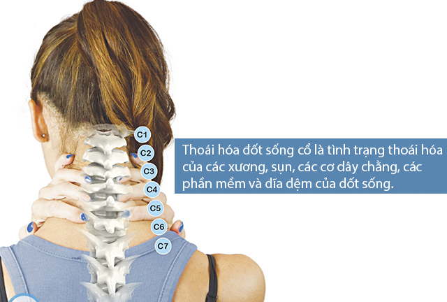 Bài thuốc trị thiếu máu não - Ảnh 1.