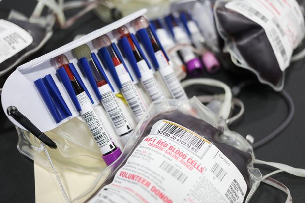 Sốt ruột về nguồn gốc Covid-19: WHO quyết định phân tích lại mẫu máu lưu trữ từ 2019 do Ý cung cấp - Ảnh 5.