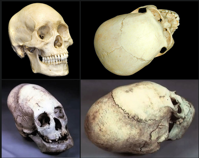 Những hộp sọ kỳ lạ nhất từng được phát hiện trong lịch sử - Ảnh 6.