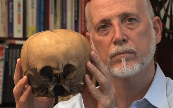 Những hộp sọ kỳ lạ nhất từng được phát hiện trong lịch sử - Ảnh 8.