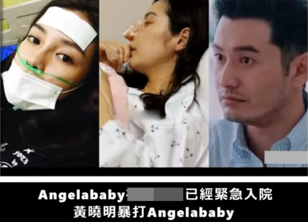 Rầm rộ tin Angela Baby bị Huỳnh Hiểu Minh đánh đập tơi bời tới mức nhập viện - Ảnh 1.