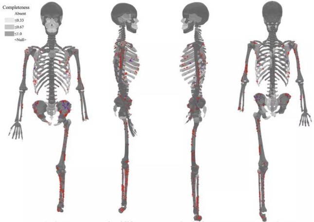 Giải mã bí ẩn bộ xương người tiền sử cụt chân: Cái chết rùng rợn, đau đớn, kinh hoàng - Ảnh 1.