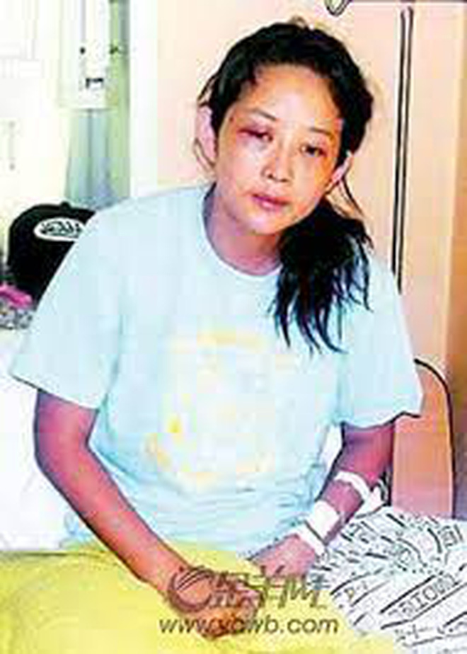 Mỹ nhân Hàn bị bạo hành: Mỹ nhân Hậu Duệ Mặt Trời - Goo Hara bị đánh dã man, rùng mình Choi Jin Sil tự tử liên hoàn và sao nữ sảy thai - Ảnh 5.