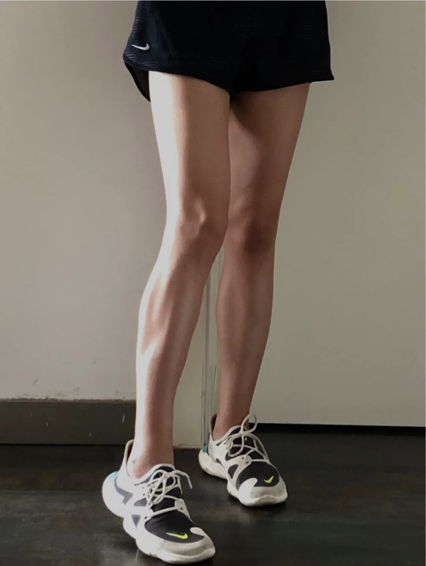 Đôi chân trong truyện tranh: Trào lưu phẫu thuật thẩm mỹ cắt bỏ dây thần kinh để sở hữu bắp chân thon gọn của các cô nàng Trung Quốc - Ảnh 3.