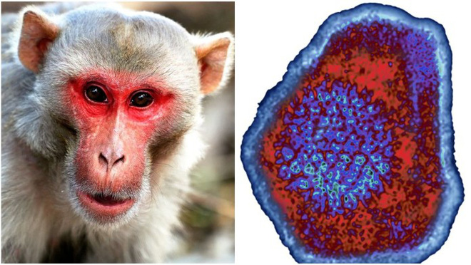 Trung Quốc lại báo cáo một virus lây từ khỉ sang người, nạn nhân đầu tiên đã tử vong - Ảnh 1.