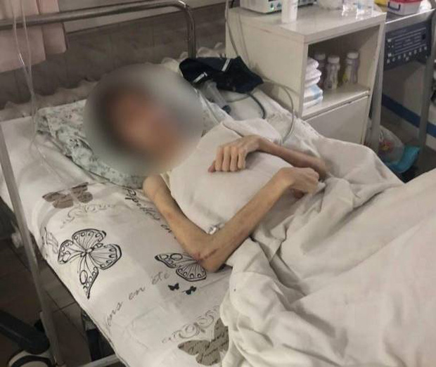 Thiếu niên 16 tuổi nặng 30kg đi cấp cứu trong bộ dạng thảm thương, biết nguyên nhân bác sĩ liền gọi cảnh sát bắt giữ người cha - Ảnh 1.