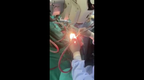 Video: Bác sĩ phẫu thuật não trong khi bệnh nhân đang tụng kinh khiến dân tình hoảng hốt - Ảnh 3.
