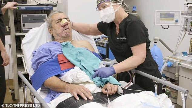 Bị 2 khối u siêu to khổng lồ mọc trên mặt, người đàn ông tuyệt vọng cầu cứu chương trình nặn mụn khét tiếng giúp đỡ - Ảnh 4.