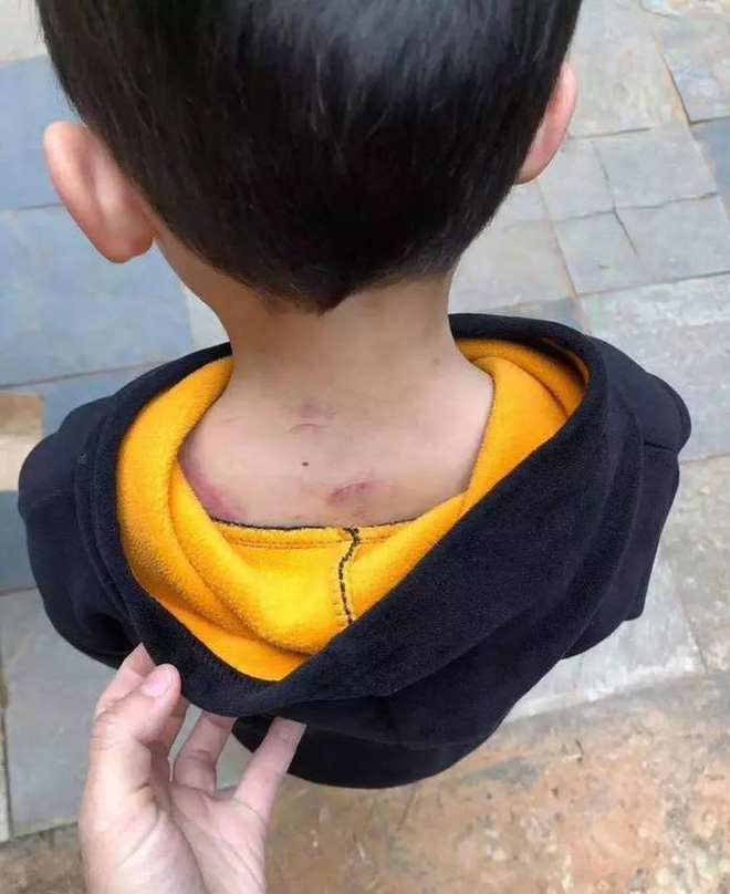 Cậu bé 5 tuổi bị đánh bầm dập giữa đường, dân tình lập tức can ngăn nhưng ông bố hành động gây phẫn nộ - Ảnh 2.