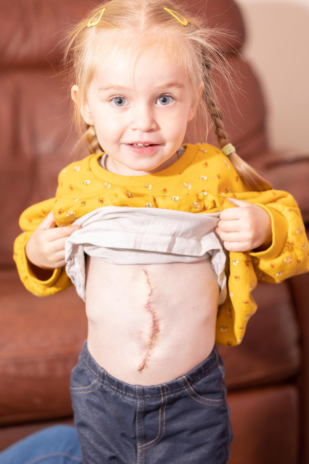 Sinh ra với dạ dày, gan, ruột đều ở bên ngoài bụng, hình ảnh hiện tại của bé gái từng làm y học thế giới đau đầu khiến ai cũng nghẹn ngào - Ảnh 7.