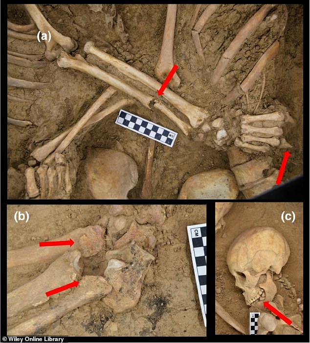 Bí ẩn người đàn ông bị mất một ngón tay, chôn cùng người phụ nữ trong ngôi mộ cổ - Ảnh 1.