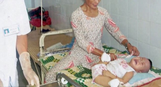 Mất 2 chân vì bố mẹ nổ bom tự sát, bé gái gốc Việt được cặp đôi Mỹ nhận nuôi, 18 năm sau gây ngỡ ngàng với diện mạo và cuộc sống phi thường - Ảnh 2.