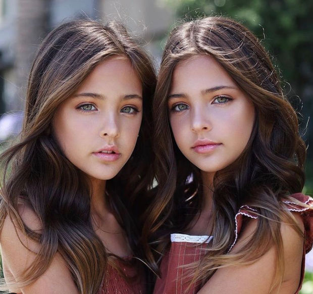 2 chị em từng được mệnh danh là “cặp song sinh xinh đẹp nhất thế giới”, được săn đón khi mới 6 tháng tuổi bây giờ ra sao? - Ảnh 18.