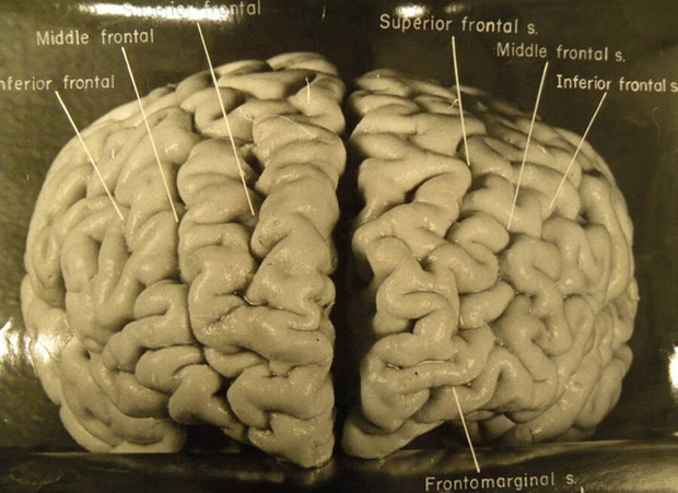 Chuyến phiêu lưu của bộ não Albert Einstein, người có IQ cao nhất thế giới, sau khi nó bị đánh cắp khỏi cơ thể - Ảnh 1.