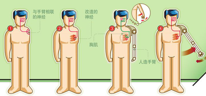 Trong tương lai, con người đều có thể trở thành những cyborg hay không? - Ảnh 4.