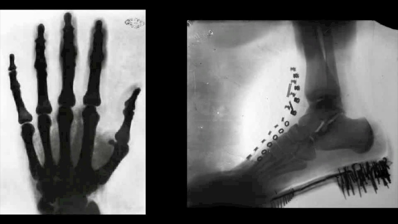 Shadowgraph Tesla Inventions Nikola Tesla là ai: Tiểu sử, sự thật nhà khoa học từ chối giải Nobel