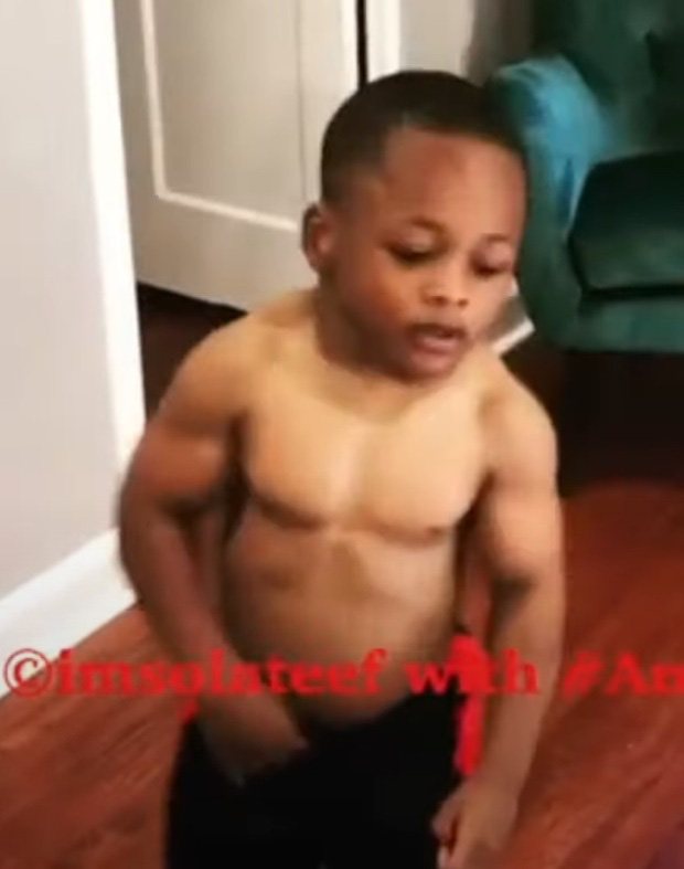 Cậu bé 8 tuổi biệt danh Hulk con có body cuồn cuộn cơ bắp vì mắc phải bệnh hiếm - Ảnh 4.