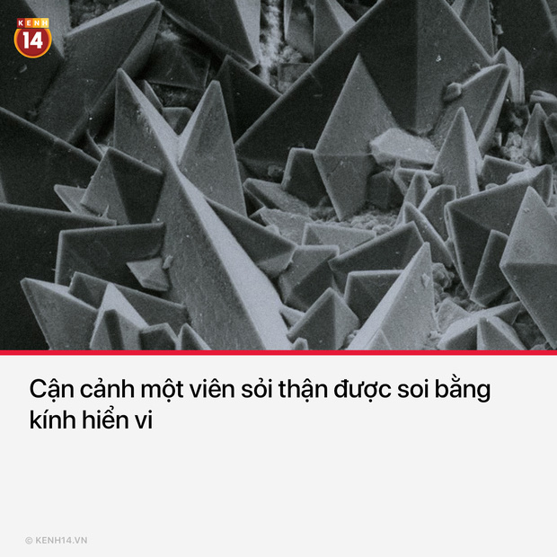 17 hình ảnh hiếm có lật tẩy những góc khuất không ai ngờ tới của cuộc sống - Ảnh 5.