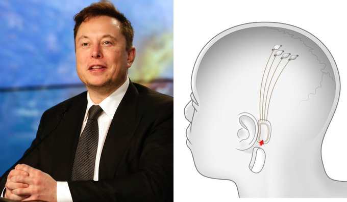 Cộng đồng so sánh việc cấy chip vào não người của Elon Musk như ‘ác mộng’ phim viễn tưởng - Ảnh 2.