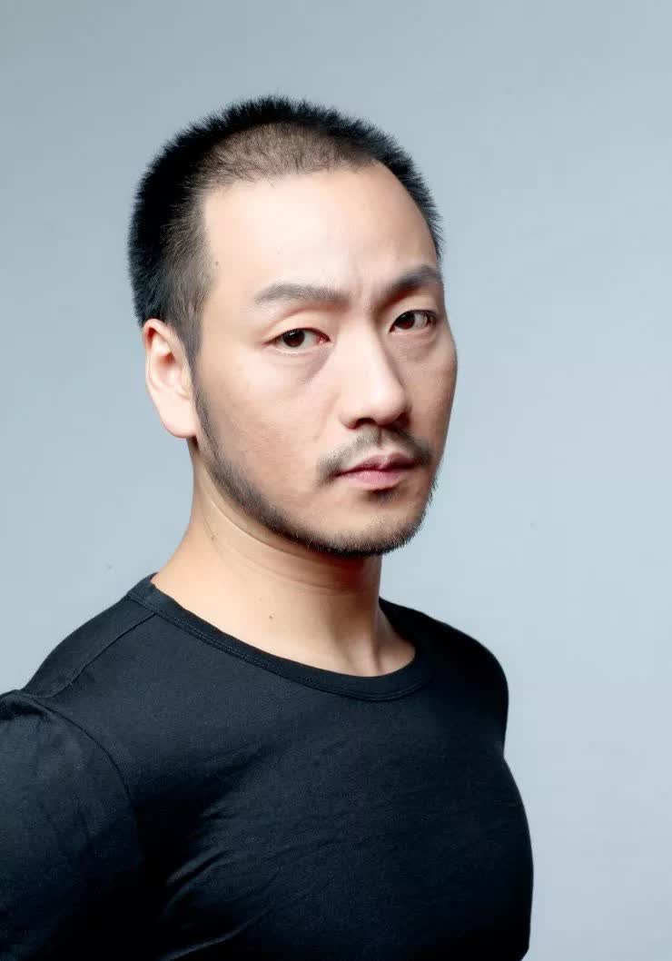 Tài tử đổi đời nhờ đi cấy tóc: Thăng hạng nam chính sau 10 năm, nổi tiếng toàn cầu - Ảnh 2.