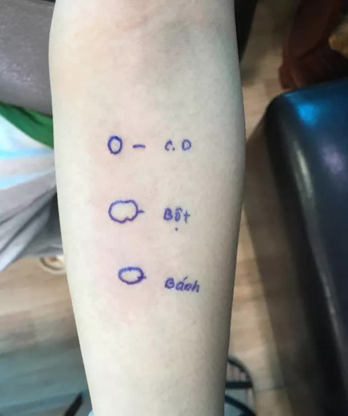 Cô gái trẻ ngất tại phòng tập do sốc phản vệ bột bánh mì - Ảnh 1. Cô gái trẻ ngất tại phòng tập do sốc phản vệ bột bánh mì - Ảnh 1.