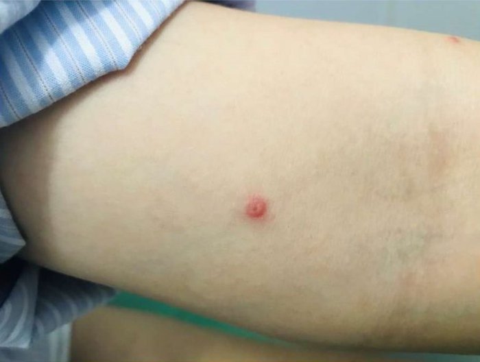 Khuyến cáo phòng ngừa lây nhiễm đậu mùa khỉ ở động vật, đặc biệt là chó nhà - Ảnh 1. Khuyến cáo phòng ngừa lây nhiễm đậu mùa khỉ ở động vật, đặc biệt là chó nhà - Ảnh 1.