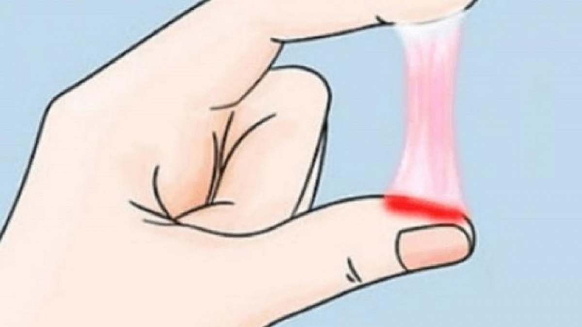 Những dấu hiệu khó thụ thai tiềm ẩn ở nữ giới - Ảnh 5. Những dấu hiệu khó thụ thai tiềm ẩn ở nữ giới - Ảnh 5.