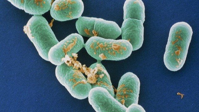 Bùng phát nhiễm khuẩn listeria chết người ở Mỹ: Liên quan thịt nguội, pho mát - Ảnh 1.