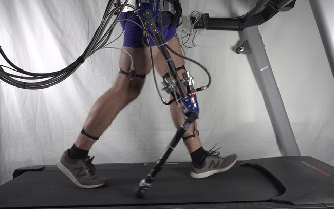 Chân robot giúp phục hồi bệnh nhân bị đột quỵ - Ảnh 1.