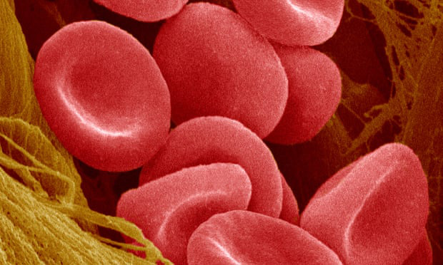 Tế bào hồng cầu nuôi cấy trong phòng thí nghiệm lần đầu tiên được truyền vào bệnh nhân - Ảnh 1.