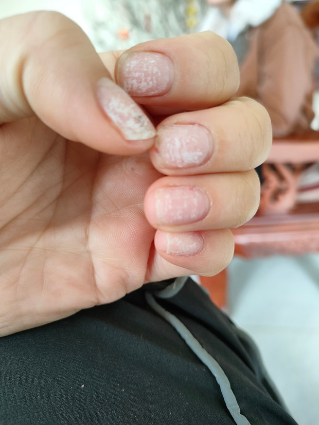 Chị em update số phận bộ nail sau mấy ng&agrave;y Tết: Người vẫn y x&igrave; đ&uacute;c, người ngậm ng&ugrave;i x&oacute;t tiền - Ảnh 8.