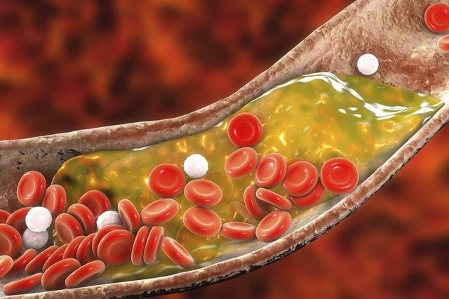 Giảm cholesterol một cách tự nhiên nhờ ăn 5 loại thực phẩm này - Ảnh 1.