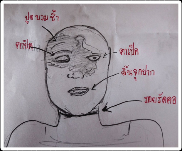 Sốc nặng hình vẽ mô phỏng vết thương trên mặt của diễn viên Chiếc Lá Bay  Bị siết cổ