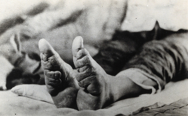 Hình ảnh của những đôi chân gót sen cuối cùng tại Trung Quốc: Nhân chứng sống ám ảnh về hủ tục đau thương bậc nhất thời phong kiến - Ảnh 15.
