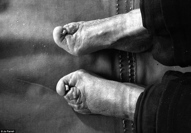 Hình ảnh của những đôi chân gót sen cuối cùng tại Trung Quốc: Nhân chứng sống ám ảnh về hủ tục đau thương bậc nhất thời phong kiến - Ảnh 6.