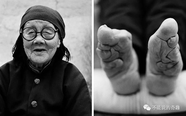 Hình ảnh của những đôi chân gót sen cuối cùng tại Trung Quốc: Nhân chứng sống ám ảnh về hủ tục đau thương bậc nhất thời phong kiến - Ảnh 9.