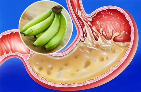 Chuối – Thực phẩm bổ dưỡng, vị thuốc hay trị nhiều bệnh - Ảnh 3.