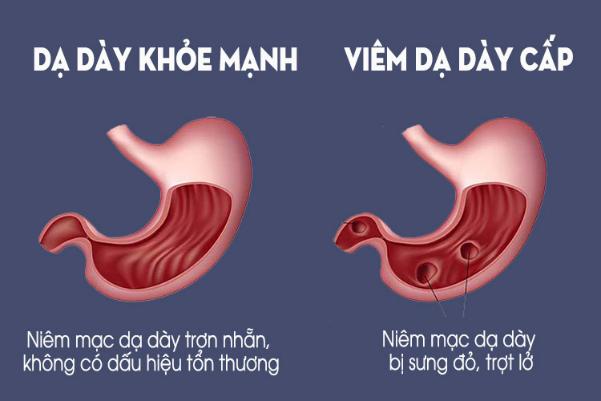 7 bài thuốc trị bệnh từ củ tỏi và những lưu ý khi dùng - Ảnh 1.