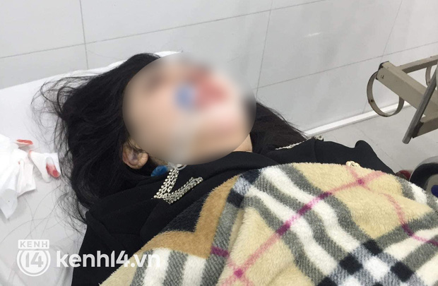 Vụ cô gái 22 tuổi tử vong do PTTM: Bệnh viện Ung bướu Hà Nội nói gì về bác sĩ tiền mê? - Ảnh 1.