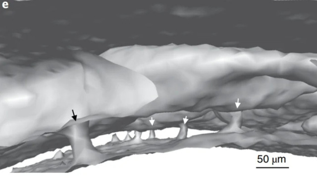 There is a mysterious tunnel connecting the brain and skull that helps transport immune cells extremely fast - Photo 1.