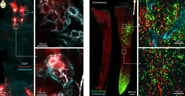 There is a mysterious tunnel connecting the brain and skull that helps transport immune cells extremely fast - Photo 2.