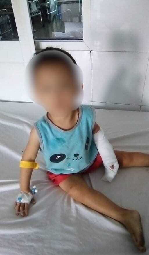 The man used a knife to cut the tendon of the 3-year-old boy's arm because of an emotional conflict - Photo 1.