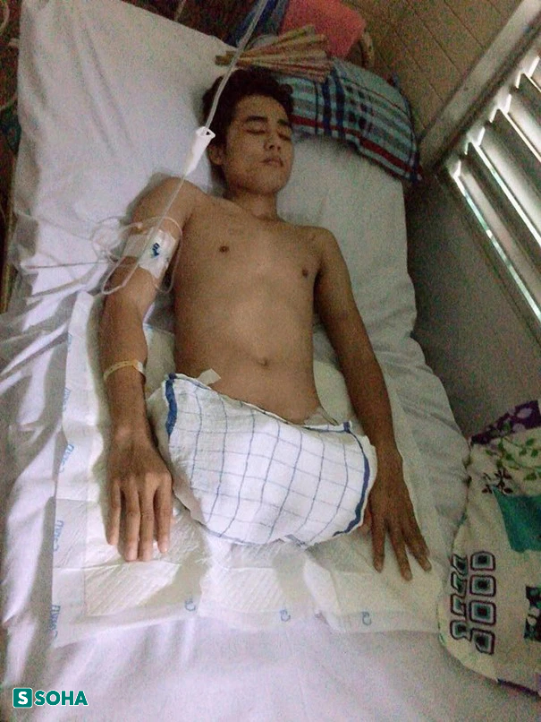 Đang ngồi bỗng thấy người t&ecirc; cứng, ch&agrave;ng trai trẻ bị cắt cụt đ&ocirc;i ch&acirc;n, 4 năm sau đổi đời - Ảnh 2.