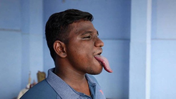 The guy has a tongue 4 times longer than normal people, knows how to do all sorts of weird things, so he is listed in the Guinness Book of Records - Photo 2.