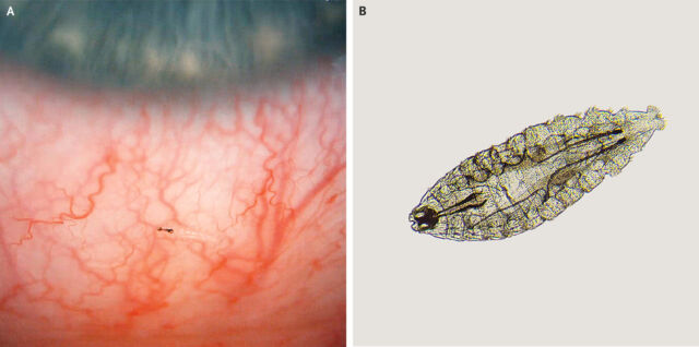 Có một loài ruồi đẻ trứng vào mắt người, nở ra đàn giòi cản trở thị lực - Ảnh 8.