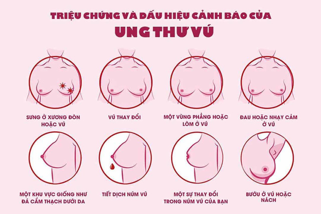 Không phải cứ sờ thấy u mới là bị ung thư vú - Ảnh 1.